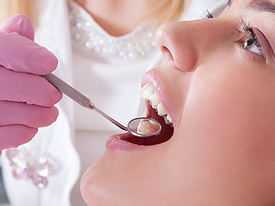A woman undergoing a dental procedure with a dentist using a drill to clean her teeth.